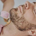 dep-laser-barba