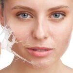 peeling-facial